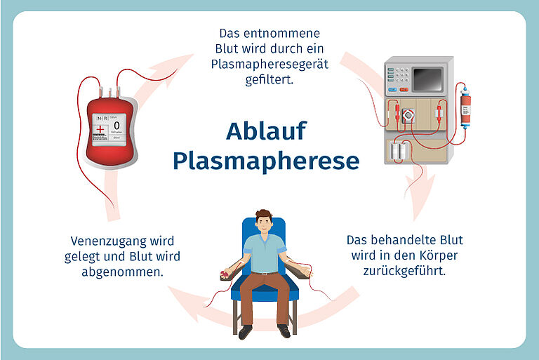Plasmapherese bei Autoimmunerkrankungen